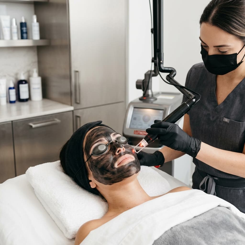 Carbon Peel Treatment